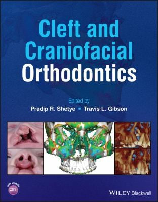 Cleft and Craniofacial Orthodontics by Travis L. Gibson — Paperback (Brand New)