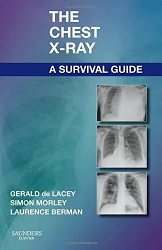 The Chest X-Ray: A Survival Guide by Gerald De Lacey Simon — Paperback (Brand New)