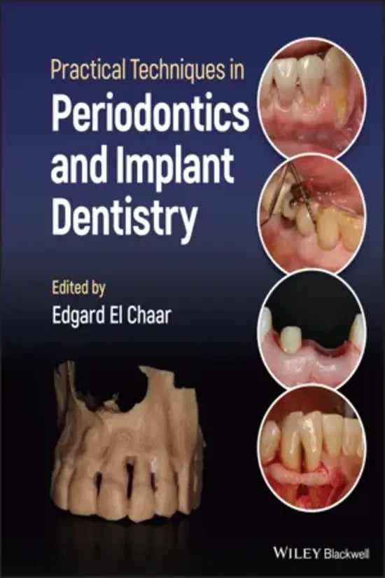 Practical Techniques in Periodontics and Implant Dentistry by Edgard El Chaar — Paperback (Brand New)