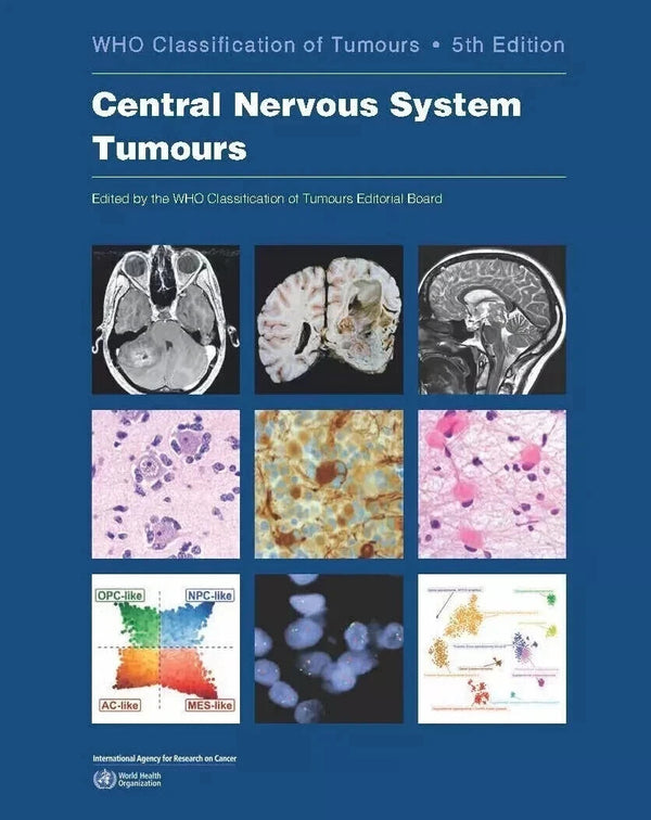 Central Nervous System Tumours 5th edition — Paperback (Brand New)